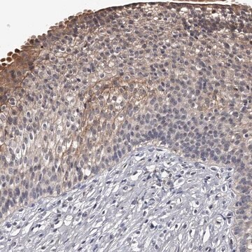 Anti-MDN1 antibody produced in rabbit Prestige Antibodies&#174; Powered by Atlas Antibodies, affinity isolated antibody, buffered aqueous glycerol solution, ab2