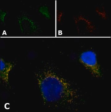 抗PMP70抗体、マウスモノクローナル clone 70-18, purified from hybridoma cell culture