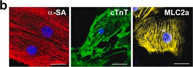 抗-&#945;-アクチン（サルコメア）抗体、マウスモノクローナル clone EA-53, purified from hybridoma cell culture