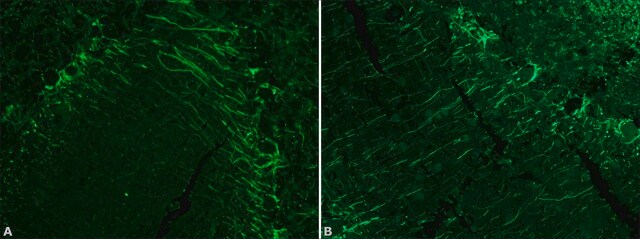 Anti-Neurofilament 200 in Kaninchen hergestellte Antikörper IgG fraction of antiserum, buffered aqueous solution