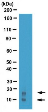 Anti-Acylation Stimulating Protein Antibody from rabbit