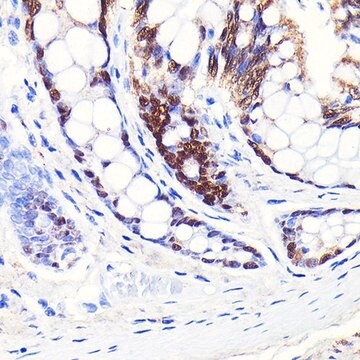 Anti-CDX2 antibody produced in rabbit