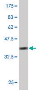 ANTI-RIPK4 antibody produced in mouse clone 4H5, purified immunoglobulin, buffered aqueous solution