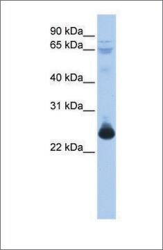 Anti-TCEAL1 antibody produced in rabbit affinity isolated antibody