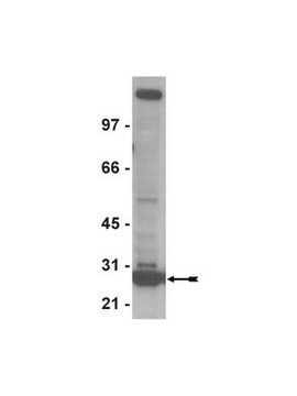 Anti-ORC6 Antibody, clone 3A4 clone 3A4, Upstate&#174;, from rat