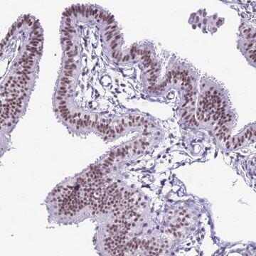 Anti-DHX15 antibody produced in rabbit Prestige Antibodies&#174; Powered by Atlas Antibodies, affinity isolated antibody, buffered aqueous glycerol solution