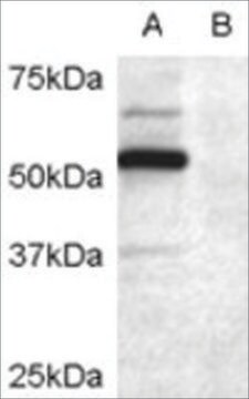 Anti-DCDC2 antibody produced in goat affinity isolated antibody, buffered aqueous solution