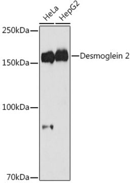 Anti-Desmoglein 2 Antibody, clone 8O0R6, Rabbit Monoclonal