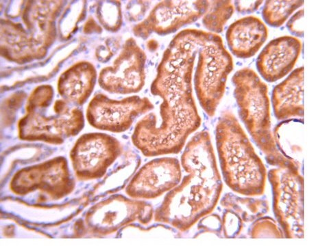 抗-PI3激酶抗体，p110&#946; from rabbit, purified by affinity chromatography