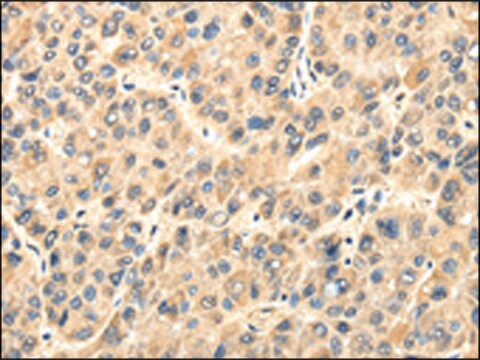 Anti-TWIST2 affinity isolated antibody