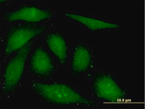 Monoclonal Anti-FGF1 antibody produced in mouse clone 3F5, purified immunoglobulin, buffered aqueous solution