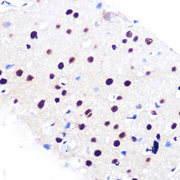 Anti- RBBP4 antibody produced in rabbit