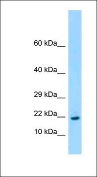 Anti-RPL26 antibody produced in rabbit affinity isolated antibody