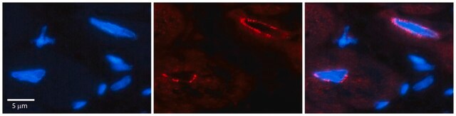 Anti-TCF20 antibody produced in rabbit affinity isolated antibody