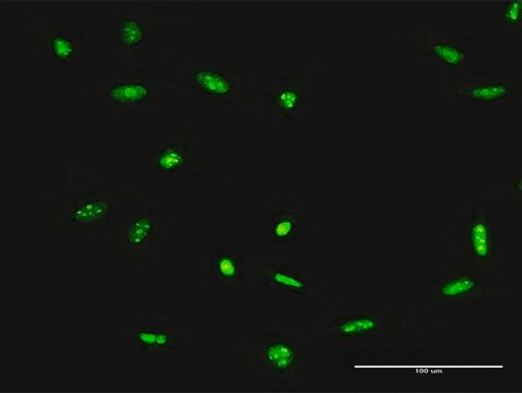 抗ADAR抗体 ウサギ宿主抗体 purified immunoglobulin, buffered aqueous solution