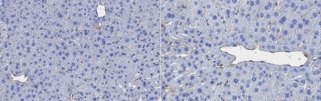 Anti-PLVAP Antibody, clone MECA-32 clone MECA-32, from rat