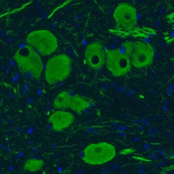 Monoklonalny anty-NEFM Prestige Antibodies&#174; Powered by Atlas Antibodies, clone CL2678, purified immunoglobulin, buffered aqueous glycerol solution