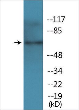 Anti-phospho-TAK1 (pThr184) antibody produced in rabbit affinity isolated antibody