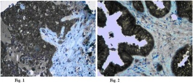 Anticorps anti-claudine&nbsp;5 from rabbit, purified by affinity chromatography