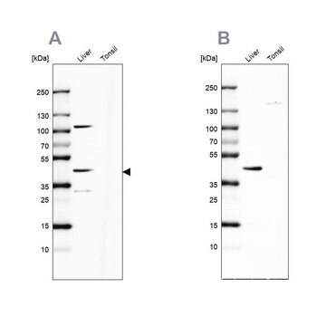 Anti-NADK2 antibody produced in rabbit Prestige Antibodies&#174; Powered by Atlas Antibodies, affinity isolated antibody, buffered aqueous glycerol solution