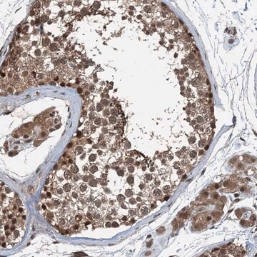 Anti-UBXN6 antibody produced in rabbit Prestige Antibodies&#174; Powered by Atlas Antibodies, affinity isolated antibody, buffered aqueous glycerol solution