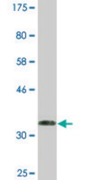 Monoclonal Anti-RRM2B antibody produced in mouse clone 6C1, ascites fluid