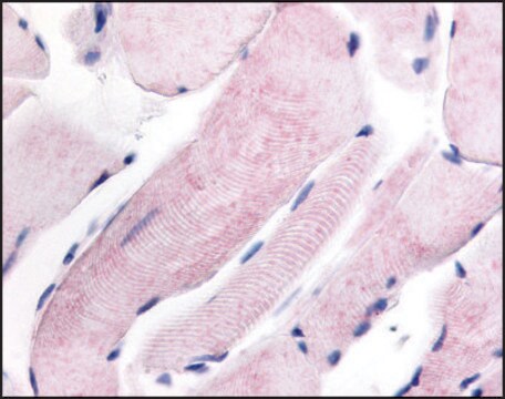 Anti-PRKWNK1 (AB1) antibody produced in rabbit affinity isolated antibody, buffered aqueous solution