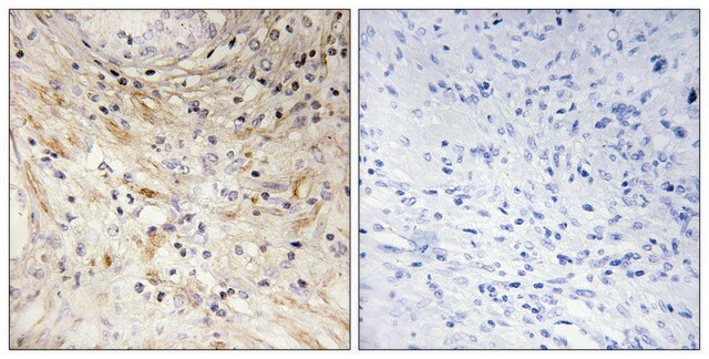 Anti-LAMB3 antibody produced in rabbit affinity isolated antibody