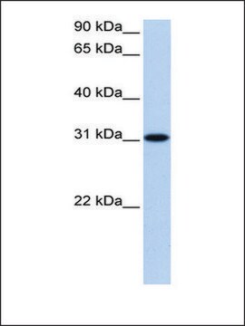 Anti-TNRC18 antibody produced in rabbit affinity isolated antibody