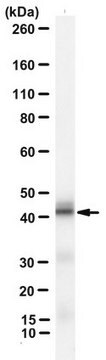 Anti-Signalpeptidpeptidase-like 3-Antikörper, Klon 7F9 clone 7F9, from mouse