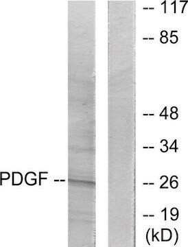 Anti-PDGFB antibody produced in rabbit affinity isolated antibody