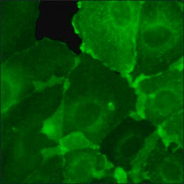 Komórki SKOV3 GFP-HER2