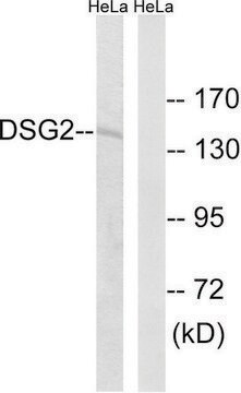 Anti-DSG2 antibody produced in rabbit affinity isolated antibody