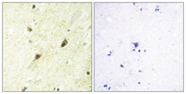 Anti-GLI-3 antibody produced in rabbit affinity isolated antibody