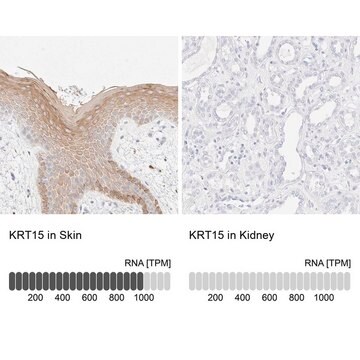 Anti-KRT15 antibody produced in rabbit Prestige Antibodies&#174; Powered by Atlas Antibodies, affinity isolated antibody, buffered aqueous glycerol solution