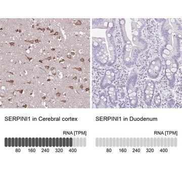 Anti-SERPINI1 antibody produced in rabbit Prestige Antibodies&#174; Powered by Atlas Antibodies, affinity isolated antibody, buffered aqueous glycerol solution