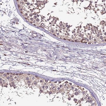 Anti-CEP55 antibody produced in rabbit Prestige Antibodies&#174; Powered by Atlas Antibodies, affinity isolated antibody, buffered aqueous glycerol solution