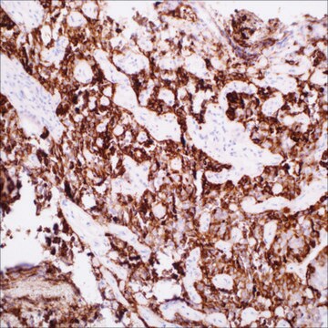 FSH (EP257) Rabbit Monoclonal Primary Antibody