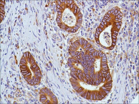 Anti-COX2 antibody, Rabbit monoclonal clone SP21, recombinant, expressed in proprietary host, tissue culture supernatant