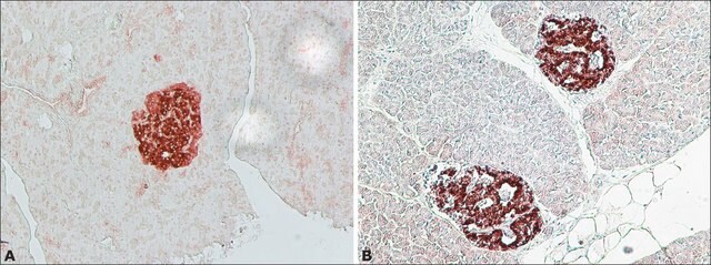 Anti-IAPP antibody produced in rabbit ~1.0&#160;mg/mL, affinity isolated antibody