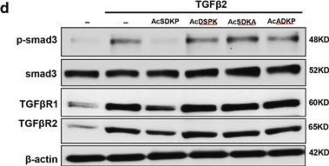 抗-TGF &#946; 受体I 兔抗 affinity isolated antibody