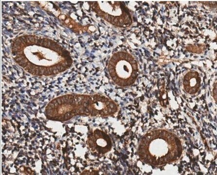 Anti-HOIP (RNF31) Antibody, clone 1CB2 clone 1CB2, from mouse