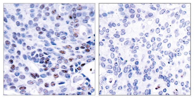 Anti-NF-&#954;B p105 antibody produced in rabbit affinity isolated antibody