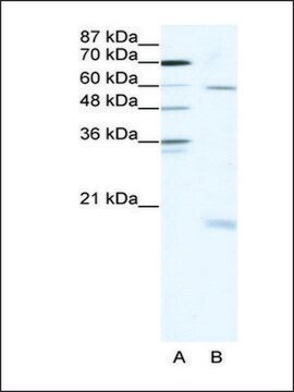 Anti-SOX9 antibody produced in rabbit IgG fraction of antiserum