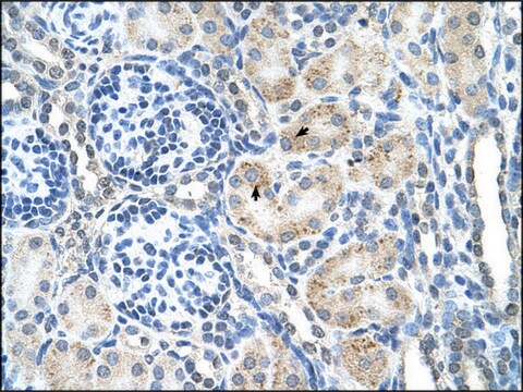 Anti-SPPL2B antibody produced in rabbit affinity isolated antibody