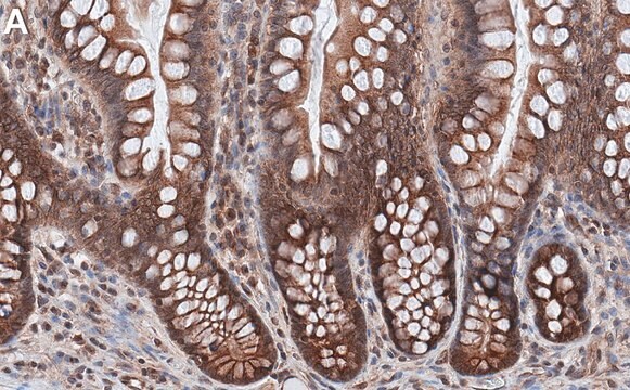 Anti-UNC93B1 Antibody, clone 2C13 ZooMAb&#174; Rabbit Monoclonal recombinant, expressed in HEK 293 cells