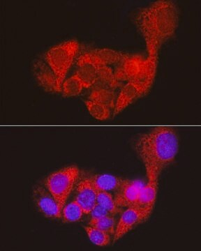 Anti-AGL Antibody, clone 8V9K5, Rabbit Monoclonal