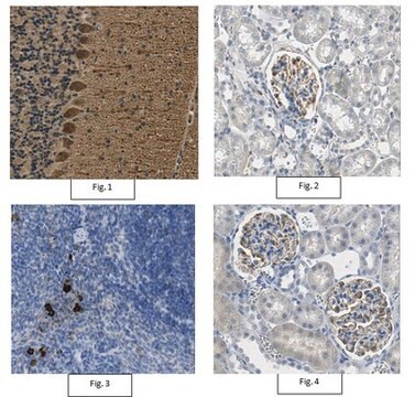 Anticorpo anti-VEGF from rabbit, purified by affinity chromatography