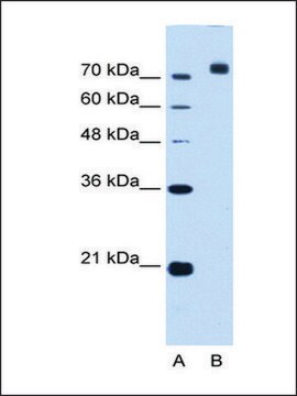 Anti-CORIN antibody produced in rabbit IgG fraction of antiserum