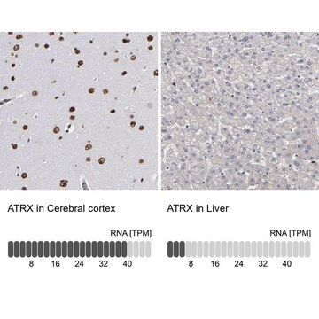 抗ATRX 兔抗 Prestige Antibodies&#174; Powered by Atlas Antibodies, affinity isolated antibody, buffered aqueous glycerol solution